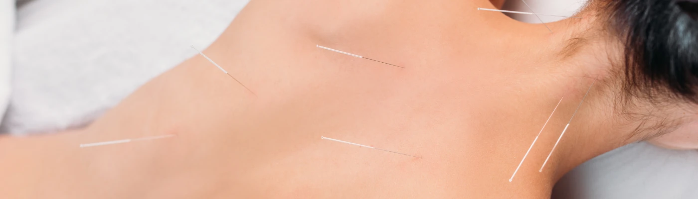 Acupuncture & TCM at Feel Amazing Wellness Centre, Chatswood